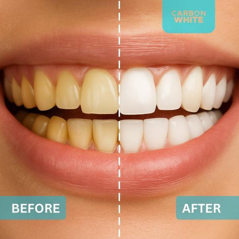 Carbon White – Charcoal Teeth Whitener Powder – Natural, Vegan, Coconut (30G) Organic Whitening - Teeth Whitening, Tooth Polish